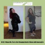 Side-by-side before-and-after photo of Tina, a JourneyLite gastric sleeve patient, showing her weight loss and increased confidence as she poses in a sparkly black outfit and fitted athletic wear after surgery with Dr. James Augusta at JourneyLite