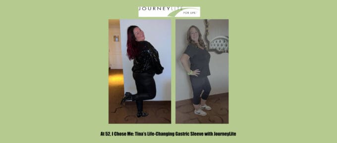 Side-by-side before-and-after photo of Tina, a JourneyLite gastric sleeve patient, showing her weight loss and increased confidence as she poses in a sparkly black outfit and fitted athletic wear after surgery with Dr. James Augusta at JourneyLite