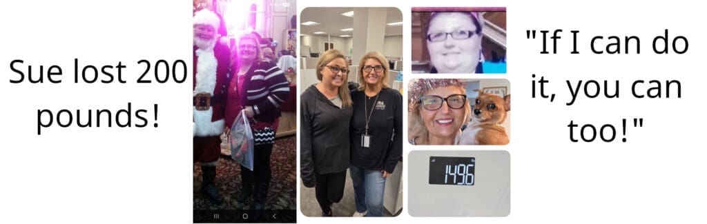 Sue’s gastric bypass transformation at JourneyLite—collage showing before photos and current weight of 149.6 lbs after losing about 200 pounds.