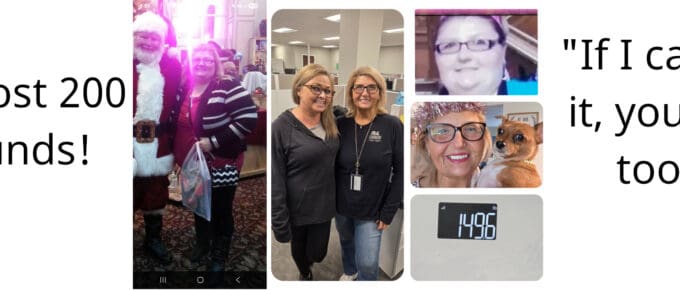 Sue’s gastric bypass transformation at JourneyLite—collage showing before photos and current weight of 149.6 lbs after losing about 200 pounds.