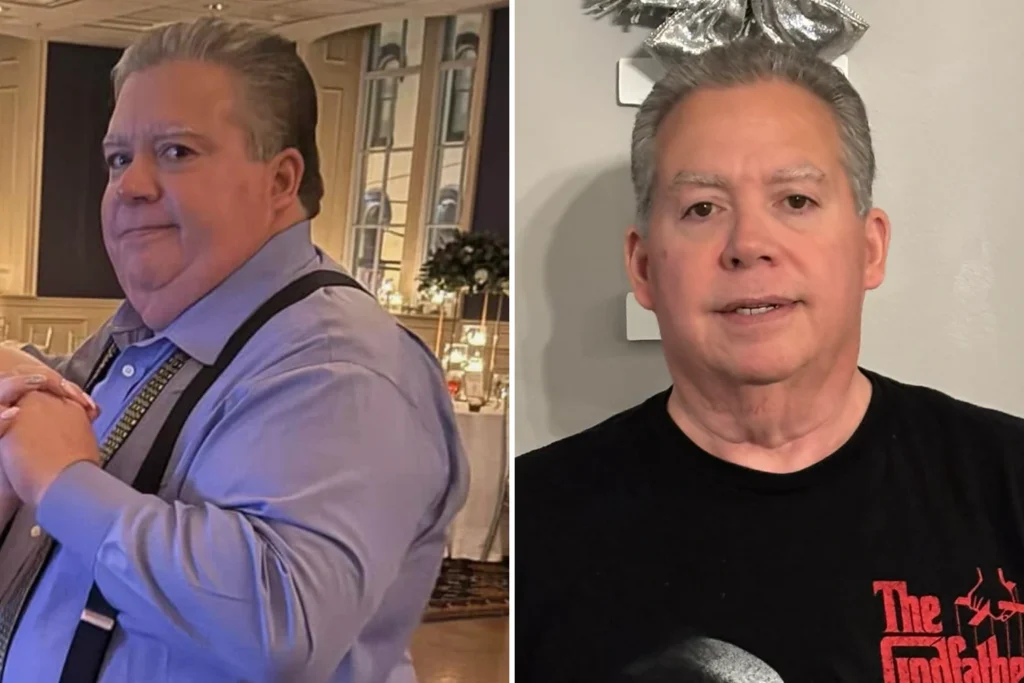 Michael before and after gastric sleeve surgery showing his approximately 106-pound weight loss at JourneyLite