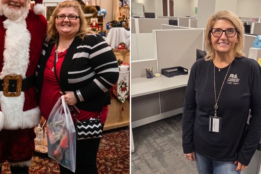 Sue before and after gastric bypass surgery showing her approximately 200-pound weight loss at JourneyLite