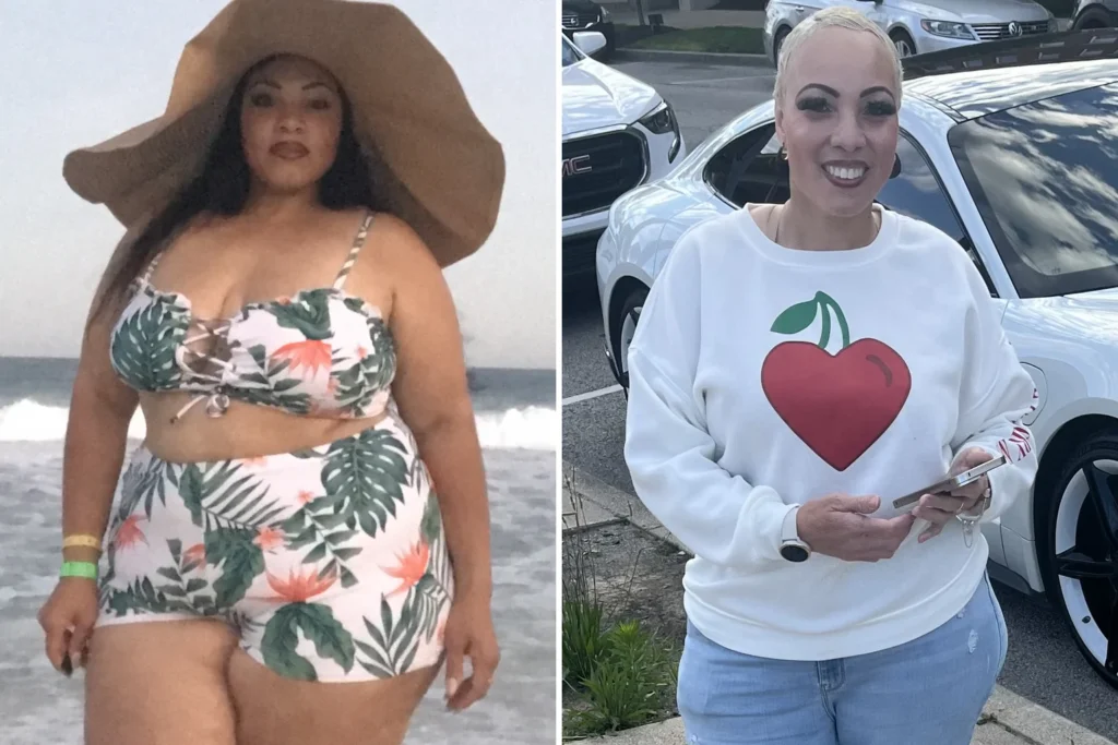 Heather before and after gastric sleeve surgery showing her 74-pound weight loss at JourneyLite