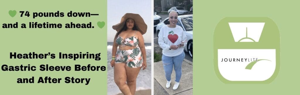 Heather before and after gastric sleeve surgery