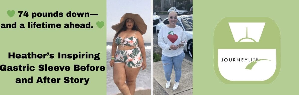 Heather’s gastric sleeve before and after transformation showing 74 pounds of weight loss with JourneyLite