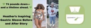 Heather’s gastric sleeve before and after transformation showing 74 pounds of weight loss with JourneyLite