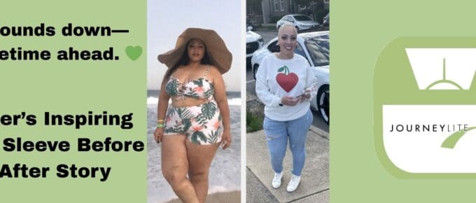 Heather’s gastric sleeve before and after transformation showing 74 pounds of weight loss with JourneyLite