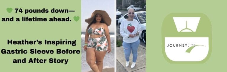 Heather before and after gastric sleeve surgery