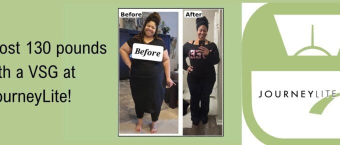 Graphic with green background reading “Robin lost 130 pounds with a VSG at JourneyLite!” beside a before-and-after photo collage and a JourneyLite scale logo.
