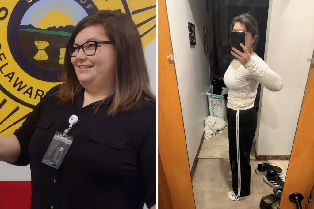 Alisa before and after gastric sleeve surgery showing her 102-pound weight loss at JourneyLite