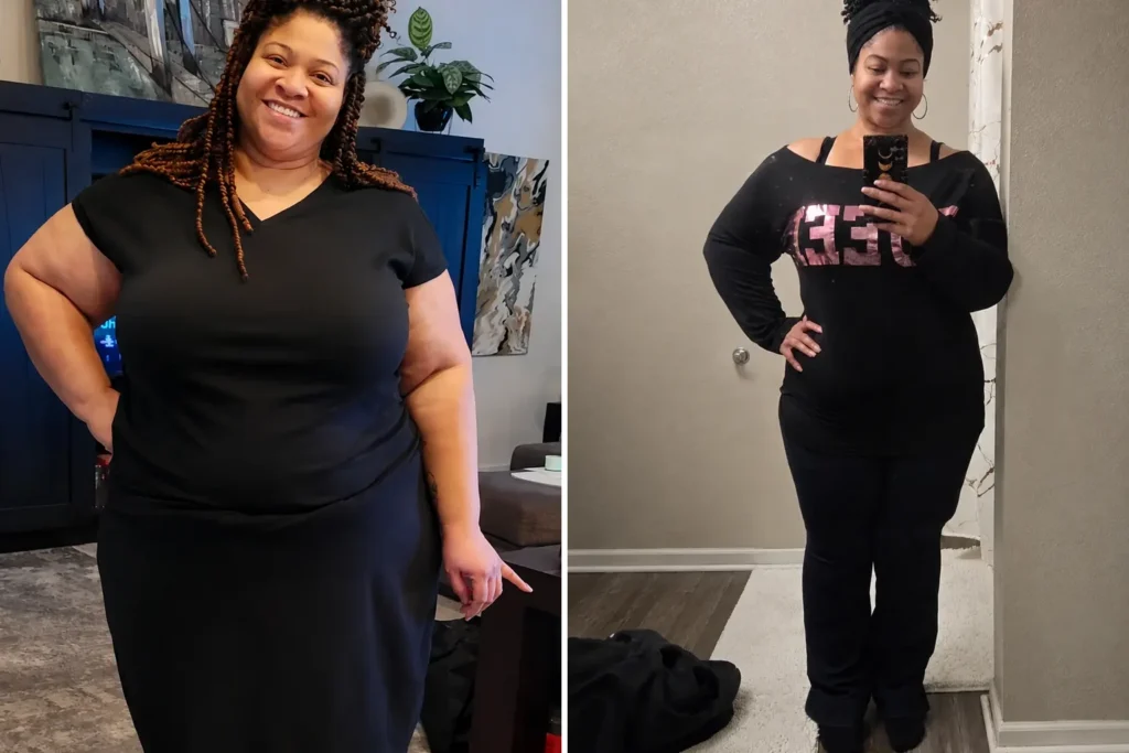 Robin before and after gastric sleeve surgery showing her 130-pound weight loss at JourneyLite