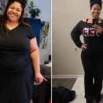 Robin before and after gastric sleeve surgery showing her 130-pound weight loss at JourneyLite