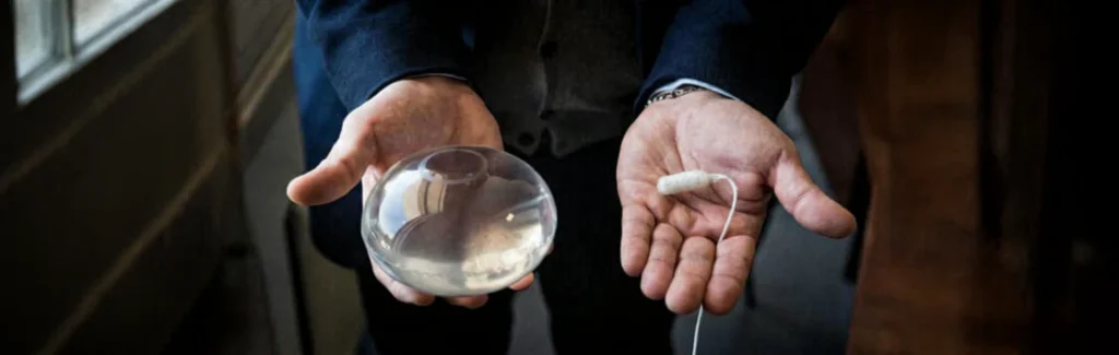 Allurion swallowable gastric balloon capsule and inflated balloon displayed side by side in a patient’s hands