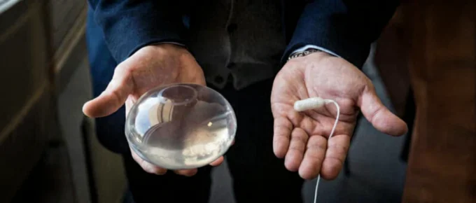 Allurion swallowable gastric balloon capsule and inflated balloon displayed side by side in a patient’s hands