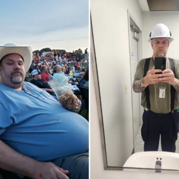 Barrett before and after gastric sleeve surgery showing his 127-pound weight loss at JourneyLite