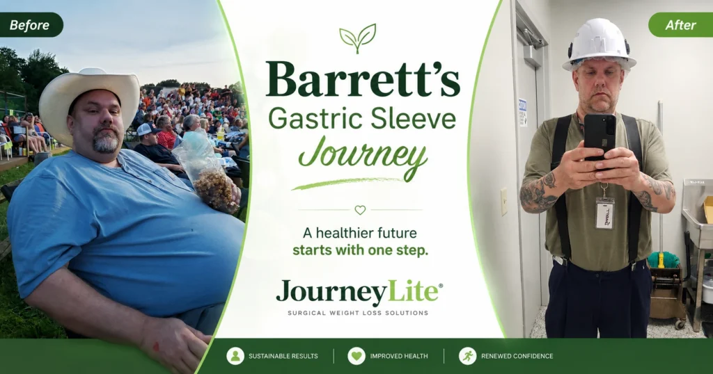 Barrett before and after gastric sleeve surgery