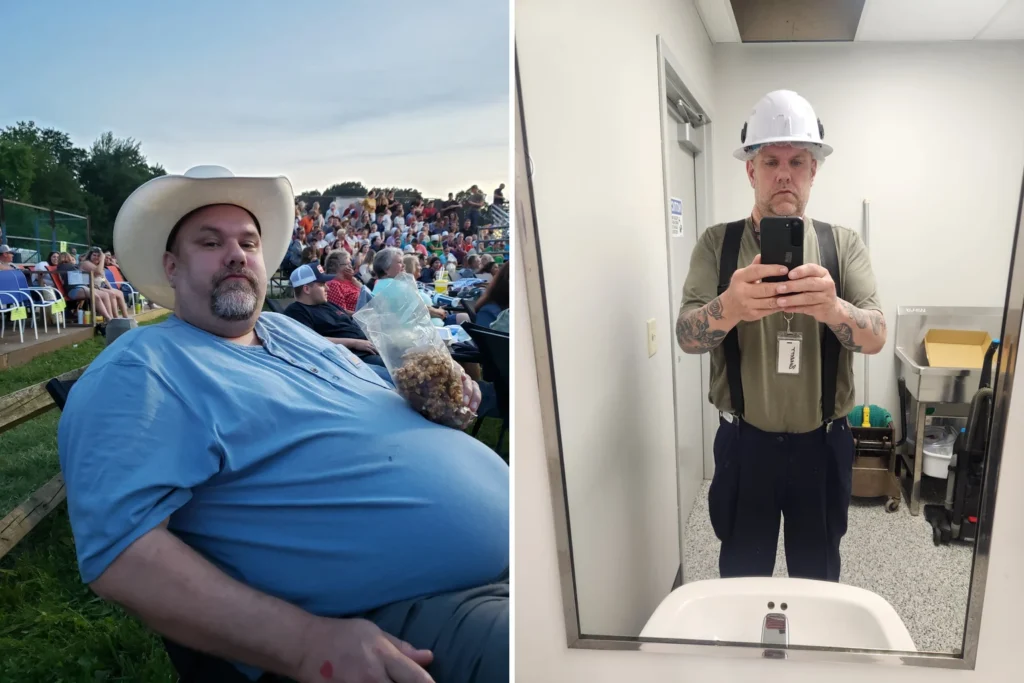 Barrett before and after gastric sleeve surgery showing his 127-pound weight loss at JourneyLite