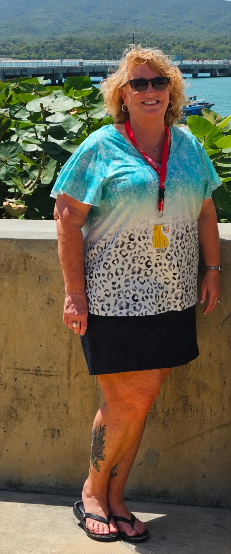 Amy before gastric bypass revision surgery at JourneyLite