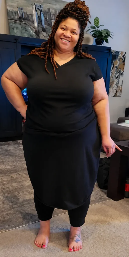 Robin before gastric sleeve surgery at JourneyLite
