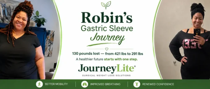 JourneyLite gastric sleeve before and after weight loss success photo of a patient named Robin, who lost 130 pounds, dropping from 421 lbs to 291 lbs.