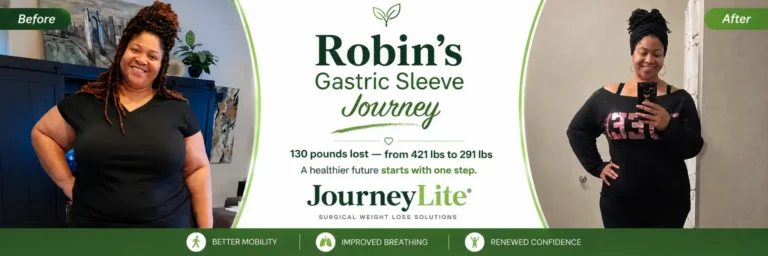 JourneyLite gastric sleeve before and after weight loss success photo of a patient named Robin, who lost 130 pounds, dropping from 421 lbs to 291 lbs.