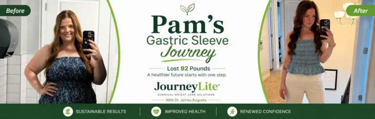 Pam gastric sleeve before and after JourneyLite VSG weight loss transformation