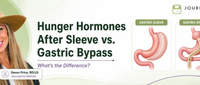 Devon Price, RD/LD, with illustrated gastric sleeve and gastric bypass diagrams explaining hunger hormone differences.