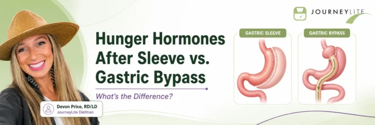 Devon Price, RD/LD, with illustrated gastric sleeve and gastric bypass diagrams explaining hunger hormone differences.