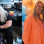 Alexa before and after gastric sleeve surgery at JourneyLite