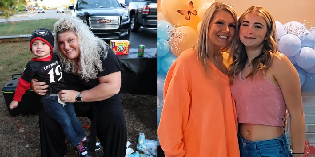 Alexa before and after gastric sleeve surgery at JourneyLite