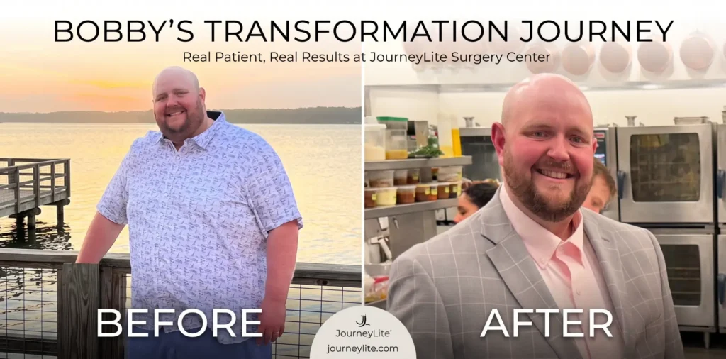 Side-by-side before and after weight loss transformation photos of Bobby at JourneyLite Surgery Center.