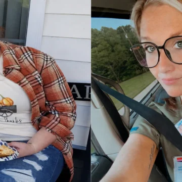 Katy before and after gastric sleeve surgery at JourneyLite after losing 146 pounds