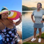Melody before and after gastric sleeve surgery at JourneyLite