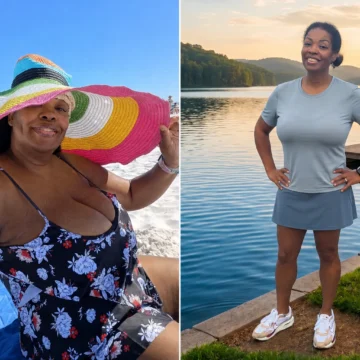 Melody before and after gastric sleeve surgery at JourneyLite