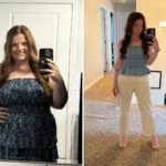 Pam before and after losing 92 pounds following gastric sleeve surgery at JourneyLite