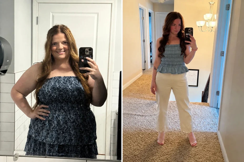 Pam before and after losing 92 pounds following gastric sleeve surgery at JourneyLite